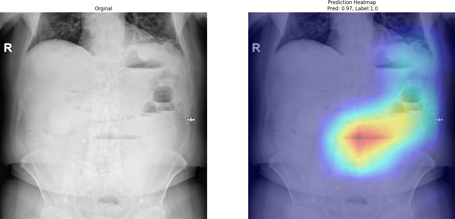 Grad-CAM visualization for MedViT